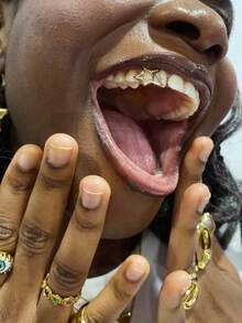 THATBOY 1 件/2 件/4 件/套女孩星形牙齿装饰，万圣节吸血鬼牙齿装饰，身体首饰，适合男女派对佩戴牙齿装饰，派对礼物，超级闪亮 - 彩色 - 查看 10