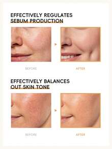 LAIKOU 4 Pcs Moisturizing LAIKOU Rice Milky Toner 100ml, Minimize Pores Hydrating Toner Mild Skin Toner Anti-Wrinkle For Women All Skin Types SPA Gift For Mom Facial Care