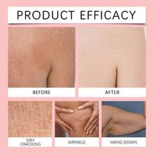 Jaysuing Magic Luxury Body Oil - Belly Butt & Thighs - Firming Deep Nourishment Lift Improve Sagging Skin Reduce Dryness Tightness Feeling Restore Skin Luster Refreshing And Not Greasy - 3.38fl.Oz - Màu be - Xem 8