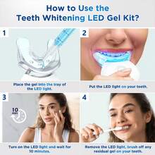 Fairywill Teeth Whitening Kit For Sensitive Teeth-1Pcs 28LED Teeth Whitening Light-3Pcs Teeth Whitening Gel -10 Min Fast Teeth Whitener- Enamel Restores Your Gleaming White Smile - Xanh và trắng - Xem 4