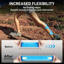 Suitable For Heel, Heel Protectors, Achilles Tendon Pads, Heel Pads, Silicone Heel Cups, For Men And Women With Cracked Heels - Multicolor - View 7