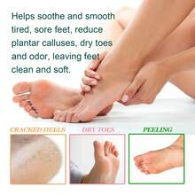 EELHOE Foot Bath Bomb Natural Old Ginger Foot Soak Ball Gentle Relax Foot Improve Sleep Quality Relief Fatigued Stress Exfoliating Reduce Remove Odor Dampness Clean Foot Bath Ball - 粉色 - 查看 6