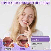 Tooth Repair Kit, Dental Cement Zinc Oxide Eugenol For Filling Chipped Broken Teeth, Missing Tooth Replacement, Dental Care Kit For Crown & Bridges,20038615 - Multicolor - View 2