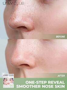 unny club 5套黑头清洁鼻贴，去角质，温和不刺激，控油，敏感肌可用，日常使用 - 彩色 - 查看 2