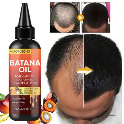 7-In-1 Hair Oil, Containing Rosemary Oil, Castor Oil, Babassu Oil, Pumpkin Seed Oil, Peppermint Oil, Biotin And Keratin, Suitable For All Hair Types, Makes Hair Longer, Thicker And Fuller.
