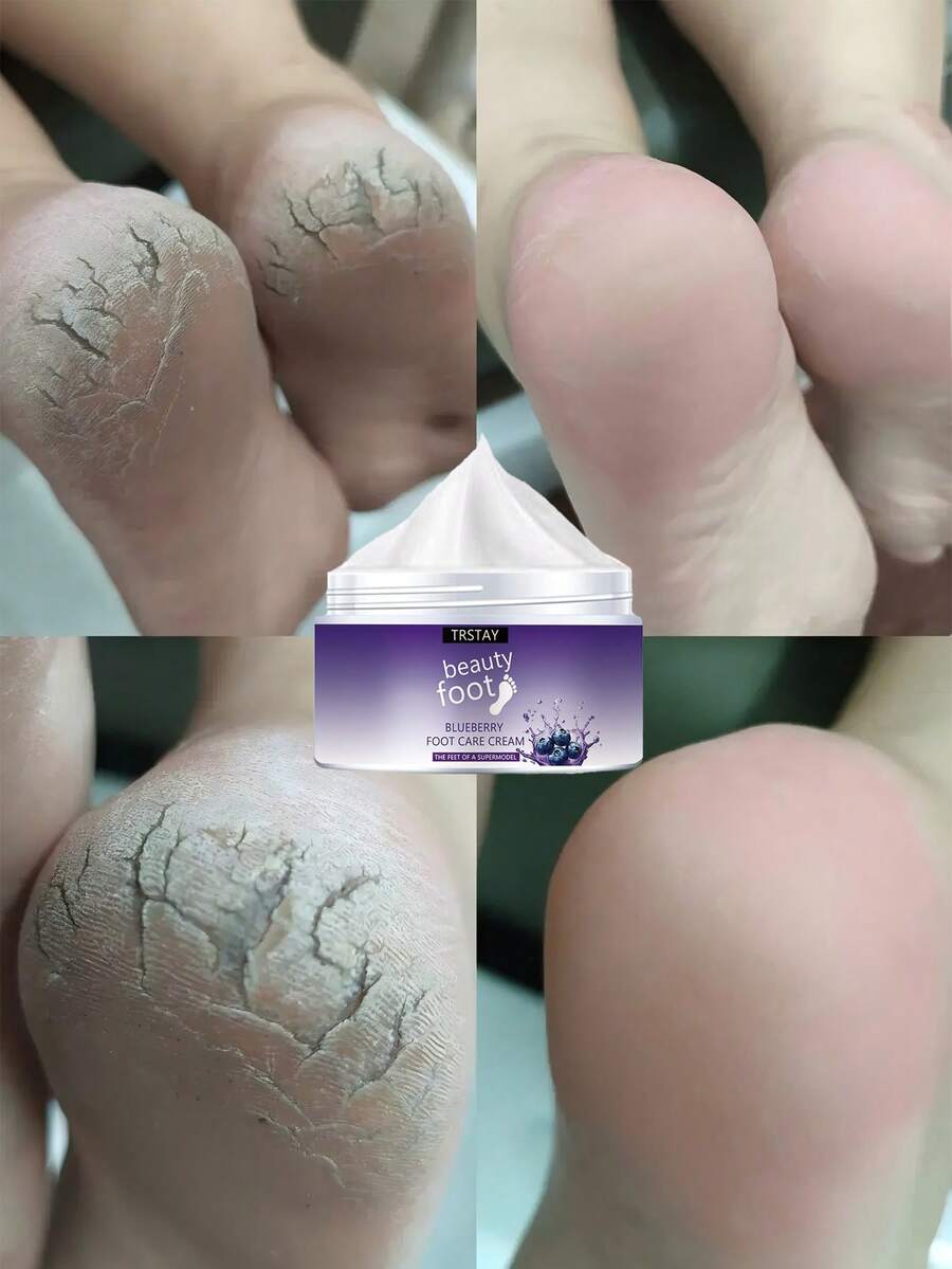 Natural Extracts Foot Cream Deeply Hydrates Repairs Cracked Heels Softens Rough Skin Long Lasting Moisture Revitalizes Tired Feet For Smooth Soft Feet All Day Enriched Formula Nourishes And Protects - Nhiều màu - Xem 1