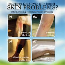 三色腿部遮瑕膏，腿部遮瑕霜，抚平腿部皱纹，有效遮盖腿部及身体疤痕，均匀肤色，防水防汗，持久妆效，打造完美腿部妆容，令双腿光滑无瑕。身体及腿部遮瑕霜，不含美黑成分，适合所有肤质。