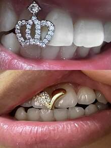 金牙套，月亮星星蝴蝶钻石牙套，男士金牙套，镀银单钻牙套，女士说唱歌手服装 - 彩色 - 查看 3