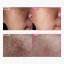 Arbutin 7% + Tranexamic Acid 4% Cream, 70,000ppm Arbutin, 40,000ppm TXA, Niacinamide, Glutathione, Dark Spots, Freckle, Blemishes, Pigmentation, Korean Skin Care, 50ml, 1.69 Fl.Oz. - 彩色 - 查看 2