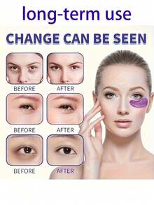 20pcs/10pairs Gel Eye Mask, Eye Care, Reduce Dark Circles, Smooth Fine Lines, Gel Eye Patches, Great Gift For Women, Friends, Christmas, Suitable For Both Men And Women