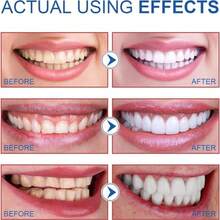 SP-6 Probióticos pasta de dientes blanqueadora, pasta de dientes probiótica SP6, promueve dientes saludables, aclaramiento y eliminación de manchas (1 unidad) - Rojo - Ver 8