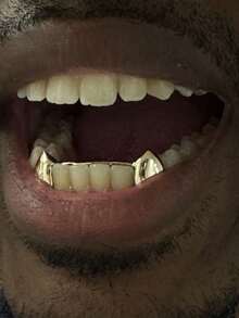 1 szt./zestaw podwójnych zębów z kłami, kombinacja kłów wampira, 6 szt. spiczastych zębów, rekwizyt na scenę Halloween, zabawny kostium cosplay hip-hopowy, unisex 1 zestaw podwójnych zębów z kłami, kombinacja kłów wampira, 6 szt. spiczastych zębów, rekwizyt na scenę Halloween, zabawny kostium cosplay hip-hopowy, unisex (dostawa losowa)