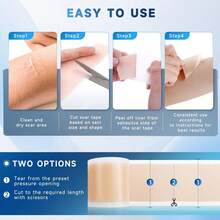 Silicone Scar Sheets, Silicone Scar Tape(1.6" X 120" Roll 3M), Silicone Scar Sheets For  Scars, Keloid Bump Removal, Stretch Marks Removal, C-Section, Burn Et