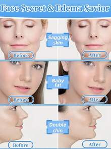 Ultra-Thin Lifting & Firming Face Mask, Invisible Lifting & Firming Face Mask, Instant Lifting & Firming Face Mask - Waterproof Transparent V-Shaped Eye Firming Patch, Suitable For Eye Area, Double Chin And Neck, Waterproof Transparent Shaping Patch, Facial Lifting & Firming Beauty Tool - Multicolor - View 7