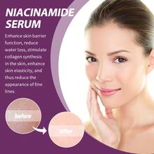 EELHOE Niacinamide Whitening Serum Anti Aging Facial Lifting Vitamin C Moisturzing Shrink Pores Smooth Oil Control Brightening Dark Spot Remover Skin Care Products For All Skin Type - trắng - Xem 8