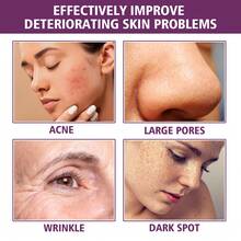 EELHOE Niacinamide Whitening Serum Anti Aging Facial Lifting Vitamin C Moisturzing Shrink Pores Smooth Oil Control Brightening Dark Spot Remover Skin Care Products For All Skin Type - trắng - Xem 3