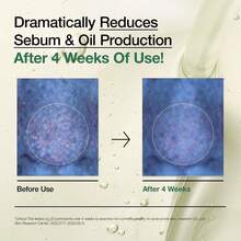 Anua 3-Step Glass Skin Beginner Set - Oil Cleanser + Face Wash + Facial Serum, Double Cleansing Routine, Heartleaf For Soothing & Niacinamide For Brightening, Daily Gentle Skincare Kit For Beginners - Bộ 3 bước Glass Skin cho người mới bắt đầu - Xem 7