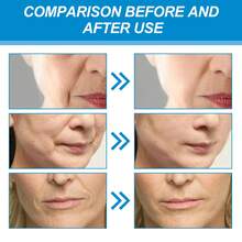 EELHOE Collagen Nasolabial Folds Patch Lighten Nasolabial Folds Lift Firm Facial Skin Fade Fine Lines Hydrogels Moisturizing Anti Wrinkle Mask 10PCS - 藍色 - 查看 9