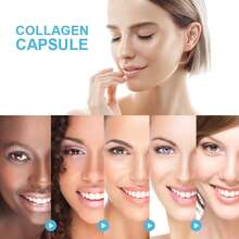 B BEWORTHS BEWORTHS Multi-Collagen Capsules (120 Capsules Per Bottle) | Colageno Para Mujer | Type I,II,III,V,X Hydrolyzed Peptides | Supports Skin Health, Joint Mobility, Hair, Digestive, Gut & Cardiovascular Health, Sleep, Stress Relief | Non-GMO Verified - New 120 tablets - 查看 6