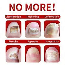 [Local Warehouse Delivery]7Days Nail Care Oil With Ginger, Nail Care Solution Hands & Feet - Moisturizing Dry, Weak & Brittle Nails - Daily Use To Strengthen & Hydrate Nails With Long-Lasting Shine, Gentle Formula Clean & Healthy Nails 1. 01oz Per Piece