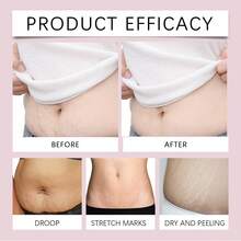 Oceaura Stretch Marks Oil, Anti-Wrinkle, Face Body Moisturizer For Stretch Marks, Sensitive Skin, All Skin Types, Improves Elasticity, Anti-Aging Firming, Nourishes Skin, Vegan Plant-Rich Nutrients, Fast Absorption, Throughout Pregnancy Skincare - White - View 10
