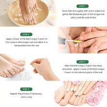 Nail Fungus Treatment & Nail GrowthSerum | Ginger Foot Spray & Plant Essential Oil Essencefor Day Nail Treatment-Cosmetic NourishingStrengthener Oil, Anti-Infection Care & Toenail Repair