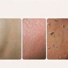 1pc/2pcs African Nylon Exfoliating Bath Towel, Soft And Scrub, Nylon Bath Towel For Exfoliating And Bubble Foaming, Bathroom Accessories Back To School-Halloween Gift