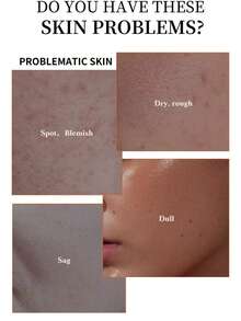 125ml Papaya Extract Brightening Facial Serum, Gently Cleanses Pores, Brightens Complexion, Improves Roughness, Deeply Nourishes And Moisturizes, Leaves Skin Radiant. - White - View 6