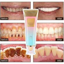 Pasta de dientes blanqueadora intensiva Slipasikao con niacinamida, 2 piezas, 100ml, sin flúor, probiótica, protección de encías, aliento fresco, protección caries, restauradora, blanqueamiento rápido - 1 pieza - Ver 8