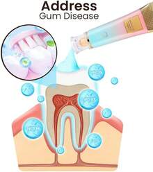 Pasta de dientes blanqueadora intensiva Slipasikao con niacinamida, 2 piezas, 100ml, sin flúor, probiótica, protección de encías, aliento fresco, protección caries, restauradora, blanqueamiento rápido - 1 pieza - Ver 5