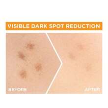 亮白全效维生素C精华液，维生素C+果酸精华液——提亮肤色，改善暗沉，提升光泽，均匀肤色——适合所有肤质，30毫升 - 彩色 - 查看 8