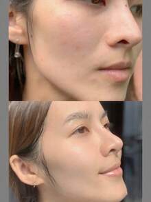 La Roche-Posay 理肤泉 CICAPLAST B5 多效修护面膜，1 片装 - 经皮肤科医生测试的舒缓配方，蕴含泛醇 B5 和甘油，有效修护肌肤屏障，减少泛红/干燥/刺激，无香料，无防腐剂，旅行装单片装，适合敏感/受损肌肤，日常紧急护理 - B5 - 查看 5