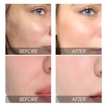 EELHOE Watermelon Nicotinamide Facial Serum - & Brightening Face Essence With Vitamin C, Fragrance-Free For All Light Beige Types, Skincare Routine, Sleek Bottle Design, Niacinamide Serum - 粉色 - 查看 7