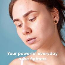 180/216/540/720/1080PCS Acne Patches, 180/216/540/720/1080PCS Day And Night Spot Patches, Gentle And Non-Irritating - Waterproof & Breathable, Concealer Acne Patches & Covering Acne And Blemishes, Face And Skin Care Acne Patches - Invisible, Ultra-Thin Must-Have - Baby Blue - View 4