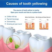 2PC New Propolis Teeth Whitening Dental Gel Teeth Whitening Essence Promotes Breath And Mouth Teeth Regrowth Dental Teeth Whitening Toothpaste 3 PCS - 3 piezas - Ver 4