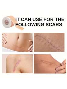 防水纹身遮盖贴，超薄背胶，适用于纹身、疤痕和胎记，浅肤色纹身遮盖胶带 - 彩色 - 查看 5