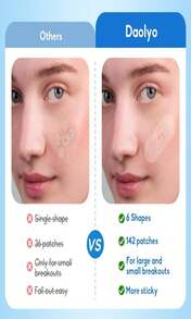 Daolyo Pimple Patches For Face, 4 Size 300 Counts Acne Patches, Hydrocolloid Patches For Covering Zits And Blemishes, Spot Stickers With Salicylic Acid, Tea Tree Oil &Amp; Calendula Oil - ColorA - 查看 5