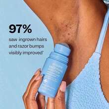 Razor Bump And Ingrown Hair Treatment, Smoothing Solution Ingrown Hair Serum, Suitable For Women And Men - Mặc định - Xem 2