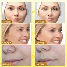 Back To School  Bee  Cream - Wrinkle Removal & Firming, Moisturizing, Lifting & Recovery For All Skin Type, Anti-Aging Bee  Cream,Face Cream Moisturiser (2pcs) - 1 - Xem 8