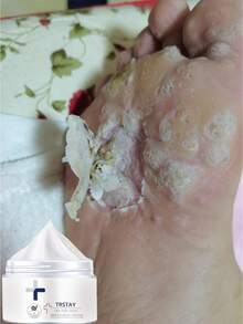 Exfoliating Foot Scrub Cream Whitening Formula Removes Calluses Hard Skin Deeply Hydrates Prevents Dryness Cracking For Soft Smooth Fragrance Free Feet - Nhiều màu - Xem 5
