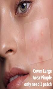 Daolyo Pimple Patches For Face, 4 Size 300 Counts Acne Patches, Hydrocolloid Patches For Covering Zits And Blemishes, Spot Stickers With Salicylic Acid, Tea Tree Oil &Amp; Calendula Oil - ColorB - 查看 5