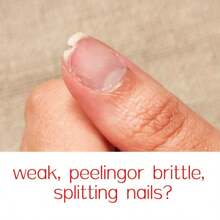 Xioimy 12ml Pink Nail Hardener, Decorative Manicure, Natural Transparent Pink Enhancing Glossy