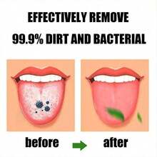 1pc Tongue Cleaner Scraper - Non Fragrant Oral Cleaning Tool, Used For Refreshing Breathing And Improving Taste - Oral Care Products,Random Color