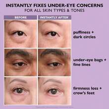 Peter Roth Instant FirmX Easy Wear Temporary Eye Tightener - 預設 - 查看 10