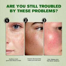 3支40毫升亮肤精华液，蕴含烟酰胺精华，深层补水，玻尿酸抗衰老，有效淡化皱纹、细纹和雀斑，男女皆宜 - 乳白色 - 查看 3