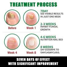 Ginger Nail Care Nail Care, Day Nail Care, Ginger Nail Growth Serum, Ginger Cuticle Care Oil Nails, Nail Cuticle Serum - Màu xanh Ô liu - Xem 4