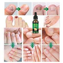 Ginger Nail Care Nail Care, Day Nail Care, Ginger Nail Growth Serum, Ginger Cuticle Care Oil Nails, Nail Cuticle Serum - Màu xanh Ô liu - Xem 3