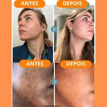 Kit Skincare Vitamina C Anti Idade Dermachem + Água Micelar Limpeza Vitamina c - Laranja - Visão 6