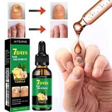 Ginger Nail Care Nail Care, Day Nail Care, Ginger Nail Growth Serum, Ginger Cuticle Care Oil Nails, Nail Cuticle Serum - Màu xanh Ô liu - Xem 6