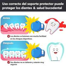 MITEGELO Protector bucal Adultos y Niños, Protector bucal Deportivo para Artes Marciales, Boxeo,, Fútbol, Rugby, Hockey, Baloncesto, Material de , con Funda Para Almacenamiento(Naranja S) - Naranja - Ver 5